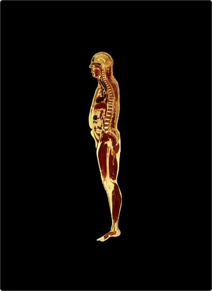 Visible Human Project: sectioned male body (side)