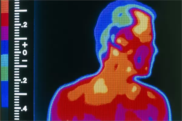 Thermogram of head & shoulders of a man