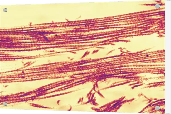 Collagen fibres, TEM