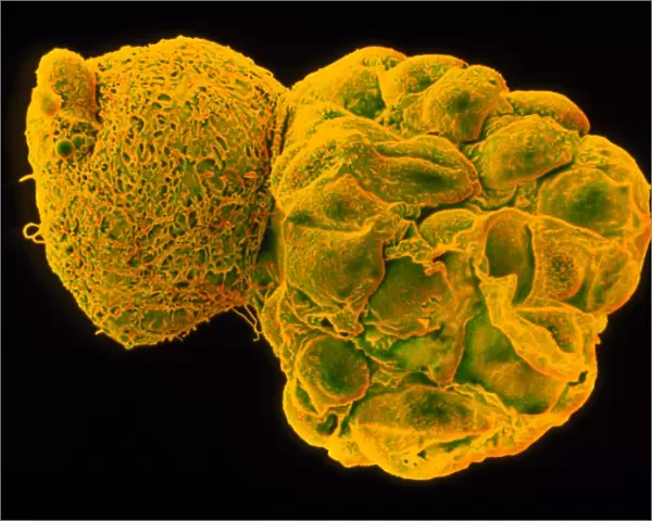 Coloured SEM of a hatching blastocyst 5 days old