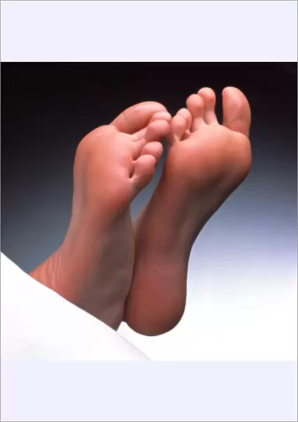Soles of feet