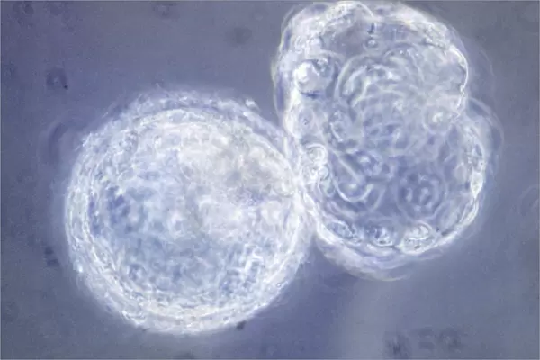 LM of hatching blastocyst in IVF