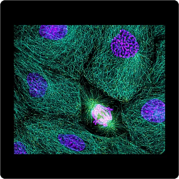 Mitosis. Immunofluorescence light micrograph of a cell 