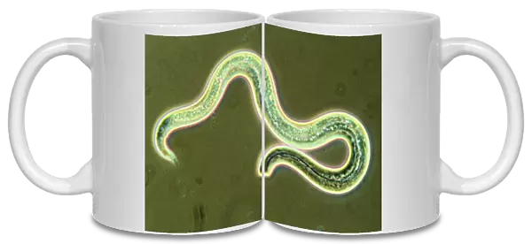 Micrograph of the first larval stage of roundworm