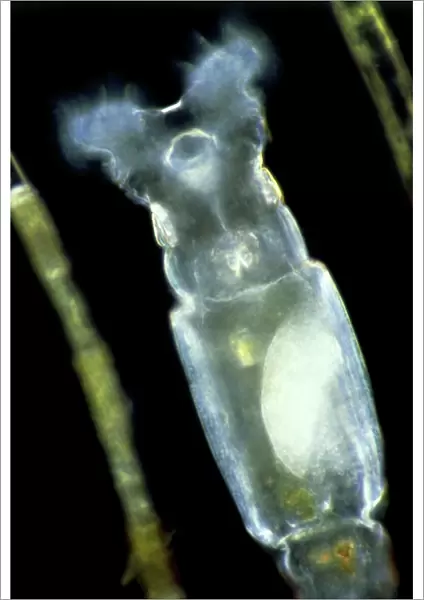 LM of common rotifer Philodina sp
