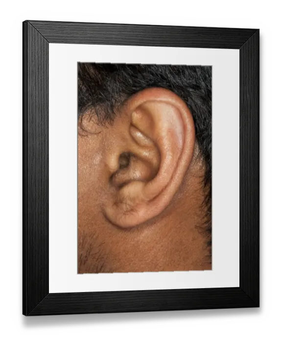 Framed Print : Human Ear Close-up Print Framed Print : Human Ear Close-up Print