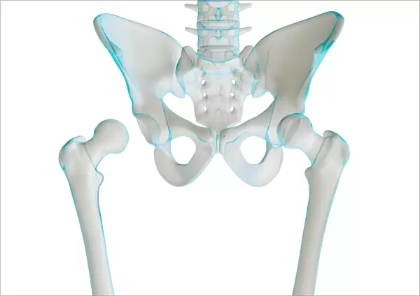 Hip joint bones and anatomy, artwork C014  /  2031