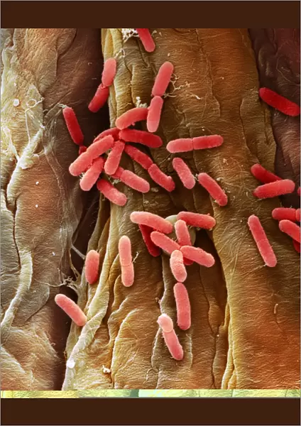 E. coli bacteria, SEM C014  /  0385