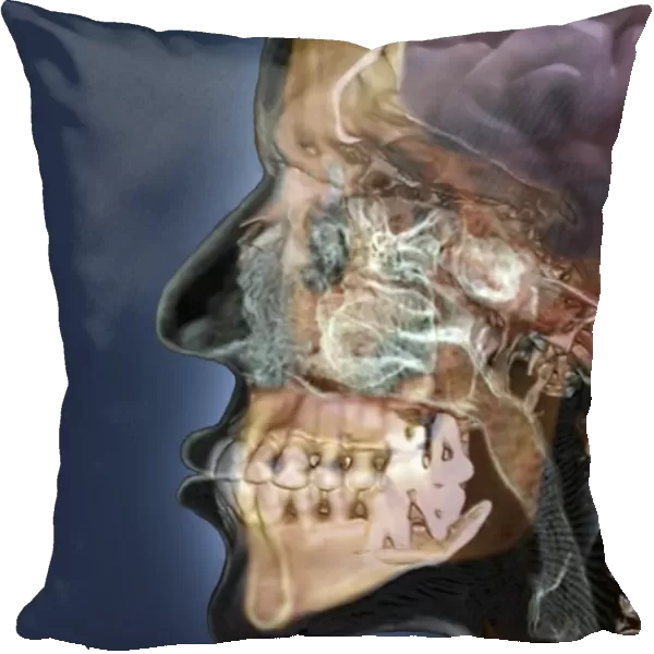 Human head, 3D CT scan C016  /  6377