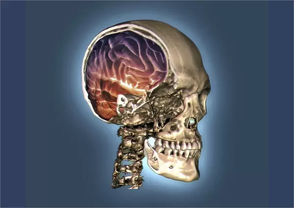 Normal skull and brain, 3D CT scan C016  /  6333