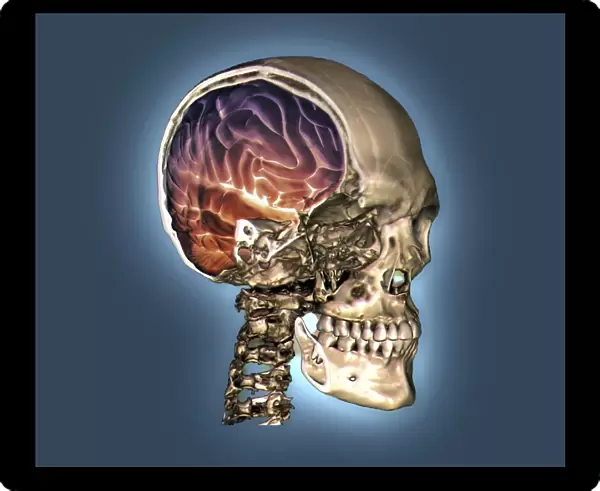 Normal skull and brain, 3D CT scan C016  /  6333