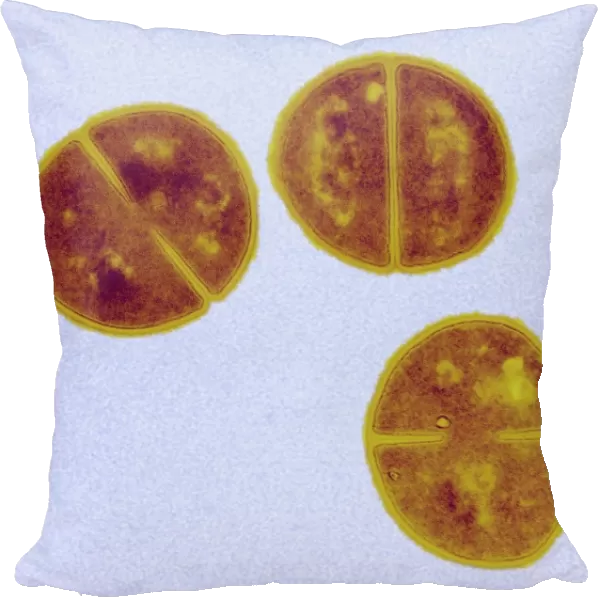 Staphylococcus aureus bacteria, TEM C016  /  9456