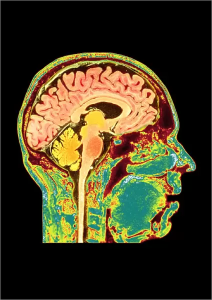 Normal human brain, MRI scan C016  /  8850