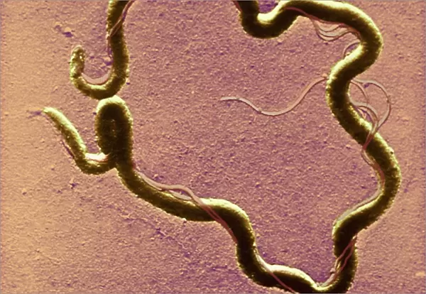Syphilis bacterium, TEM C016  /  9462