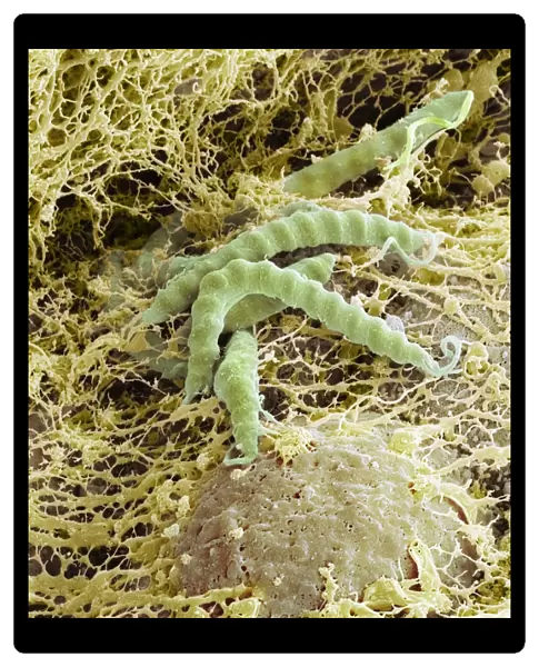 Helicobacter pylori bacteria, SEM C016  /  9136