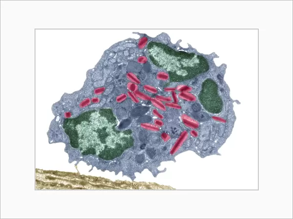 Eosinophil white blood cell, TEM C014  /  1439