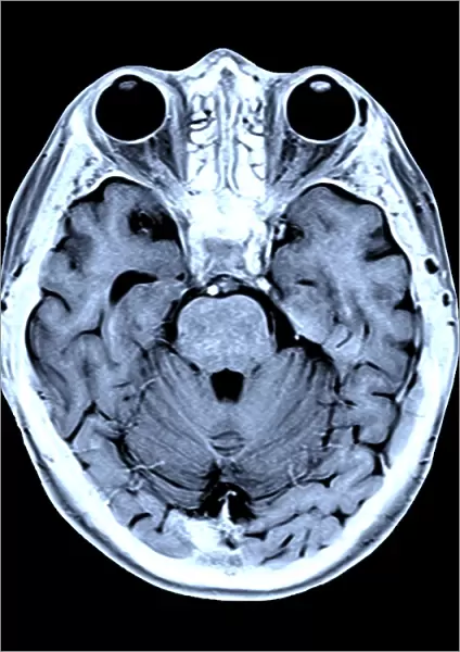 Coloured MRI scan of the human head F007  /  4205