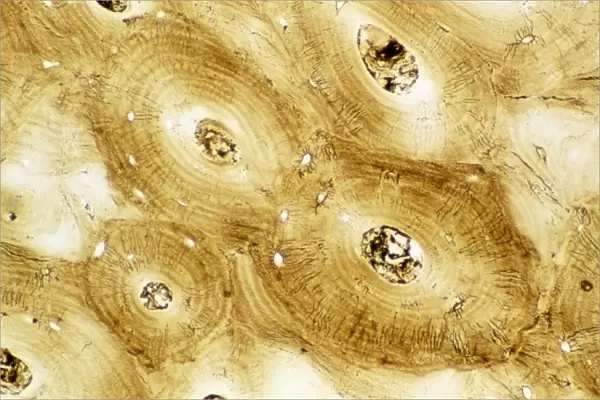 Light micrograph of normal human compact bone