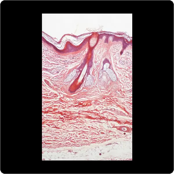 Human skin section, light micrograph P710  /  0472