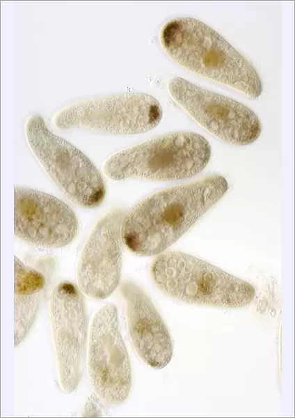 Chilodonella ciliate protozoa, LM