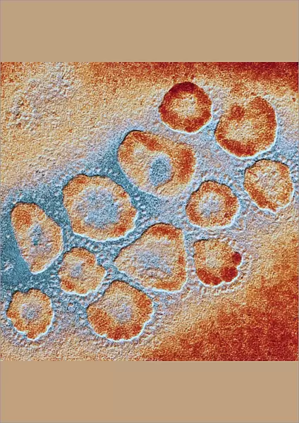 TEM of a cluster of corona viruses F007  /  9886