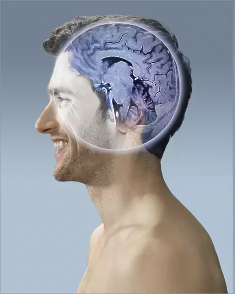 Brain scan, conceptual image C017  /  7398