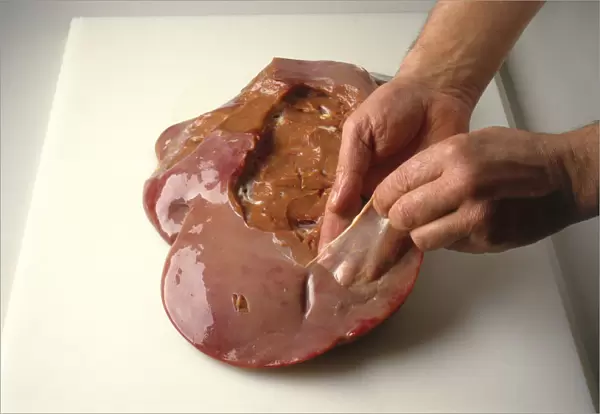 Peeling off the outer membrane of liver, using fingers, close-up