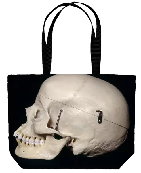 Female skull, side view