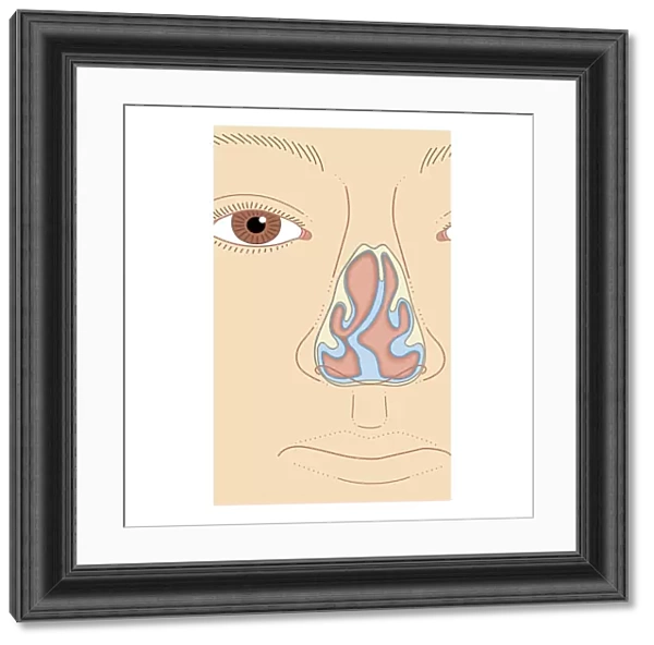 Cross section biomedical illustration of nasal septum deviation, close-up