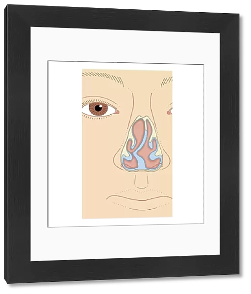 Cross section biomedical illustration of nasal septum deviation, close-up