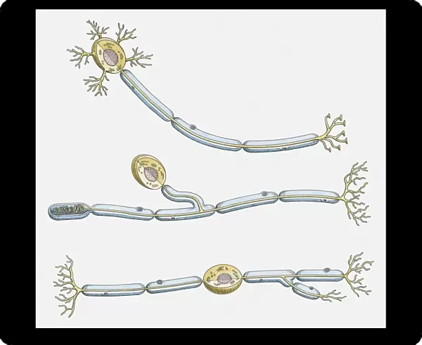 Illustration of multipolar, unipolar, and bipolar neuron