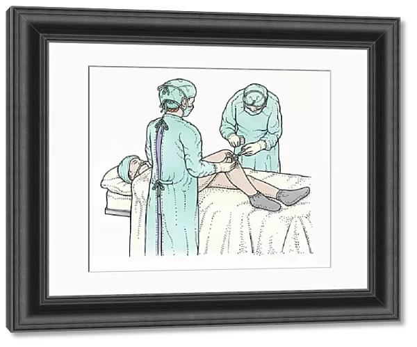 Illustration showing surgeon swabbing and removing object from knee of patient lying on operating table