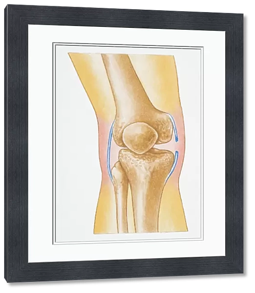 Illustration showing torn human knee ligament