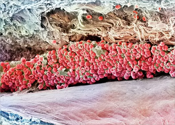 Scanning electron micrograph (SEM) of red blood cell