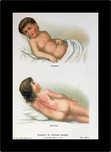 Measles and scarlet fever, from a family medical book, c. 1900 (colour litho)