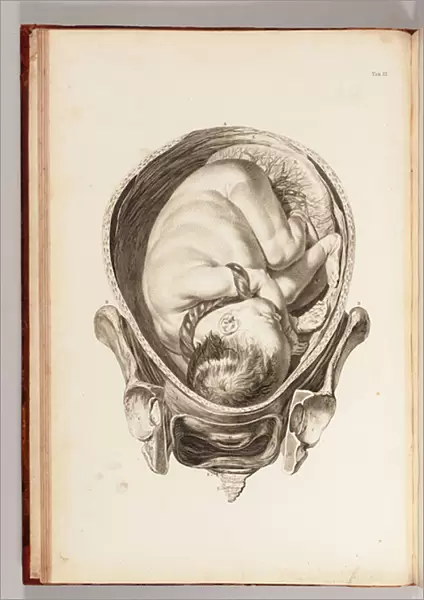 Engraving of a child in the womb from A Set of Anatomical Tables, with Explanations