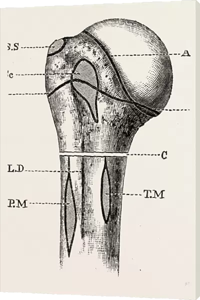 diagram, medical equipment, surgical instrument, history of medicine