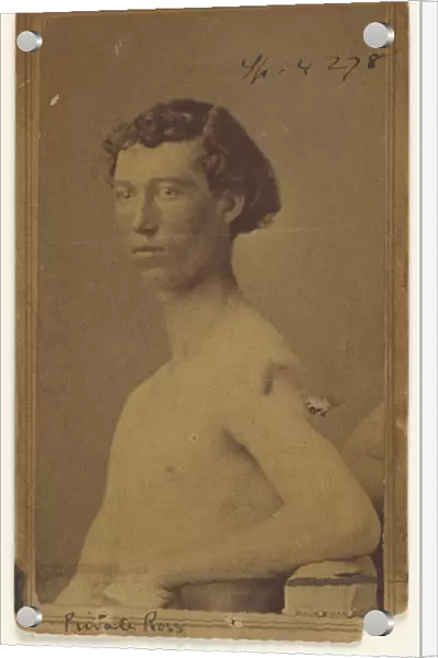 Private Ross Civil War victim Attributed William H