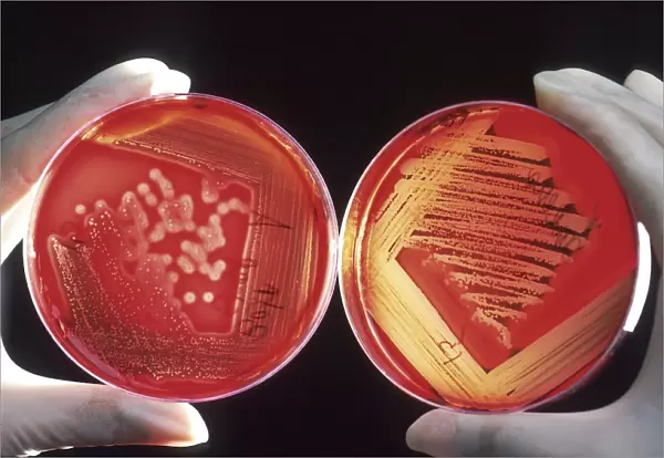 Red blood cells on an agar plate are used to diagnose infection