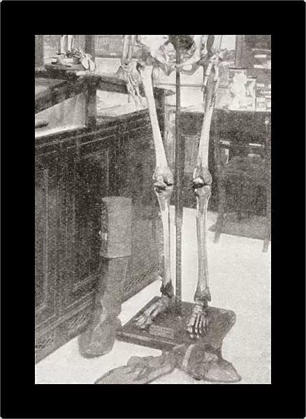 The Skeletons Of Charles Byrne, 1761A