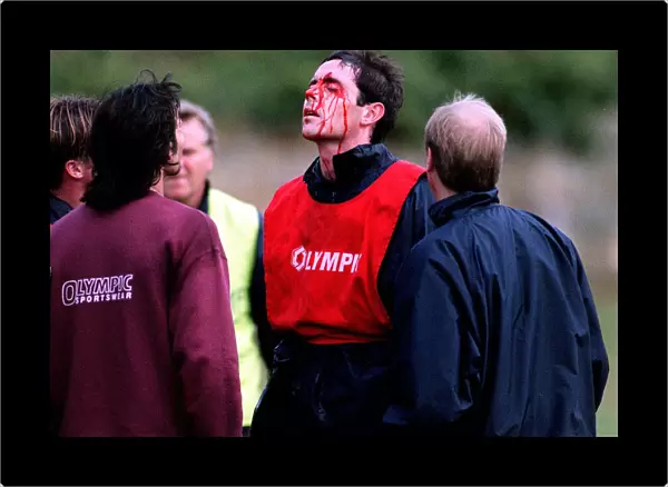 Heart of Midlothian footballer David Weir with a bloody face after a clash with teammate