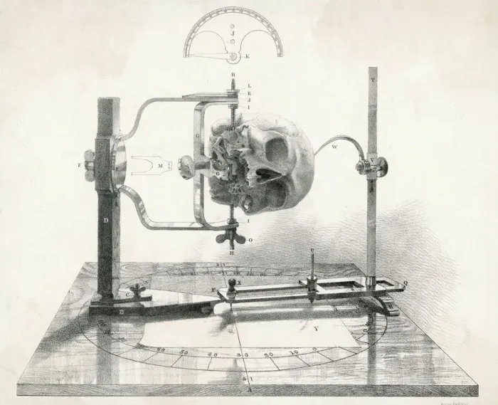 Framed Print : Craniometer Print: Mid 19th Century Skull Measurement Device Framed Print : Craniometer Print: Mid 19th Century Skull Measurement Device