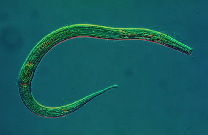 Framed Print : Roundworm Nematode Print: Unsegmented Cylindrical Specimen Framed Print : Roundworm Nematode Print: Unsegmented Cylindrical Specimen