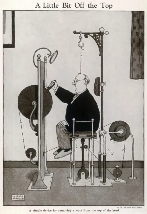 Framed Print : A Complicated Wart Removal Device Print Framed Print : A Complicated Wart Removal Device Print