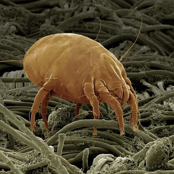 Scanning Electron Micrograph (SEM): Dust Mite; Magnification x 600 (A4 size: 29. 7 cm width)