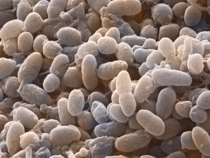 Framed Print : Acetobacter aceti bacteria print, coloured SEM Framed Print : Acetobacter aceti bacteria print, coloured SEM