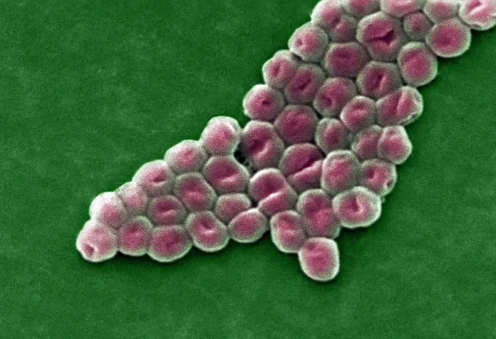 Framed Print : SEM Print of Acinetobacter baumannii Bacteria Framed Print : SEM Print of Acinetobacter baumannii Bacteria