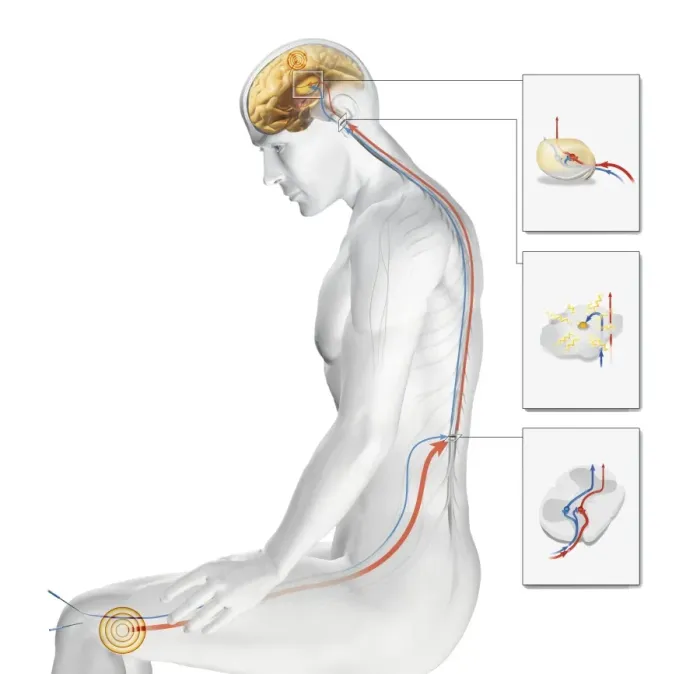 Framed Print : Acupuncture Print Framed Print : Acupuncture Print