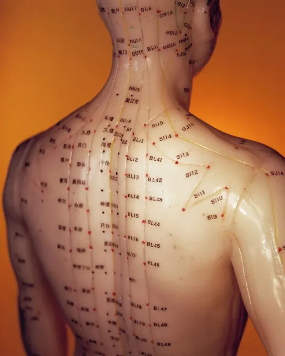 Framed Print : Acupuncture Model Print Framed Print : Acupuncture Model Print