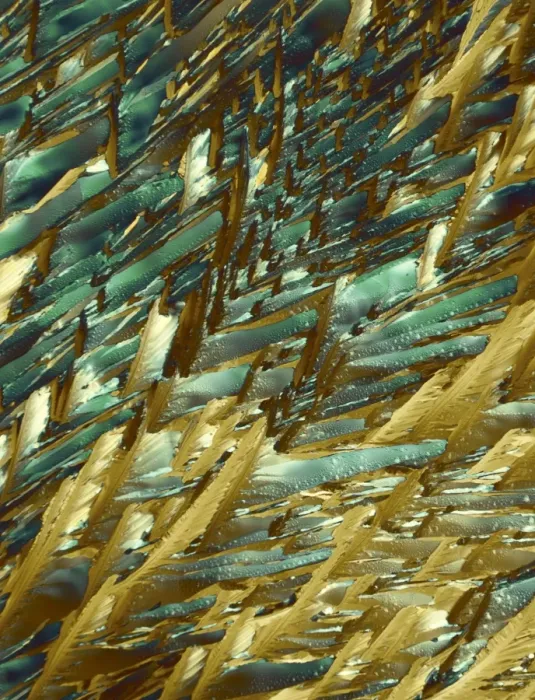 Framed Print : Print of Adrenaline Crystals under Polarized Light Microscopy Framed Print : Print of Adrenaline Crystals under Polarized Light Microscopy